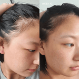 Vida Glow | Advanced Repair Hairology - 30 Capsules | THE FIND
