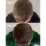 Anti hair loss serum model image